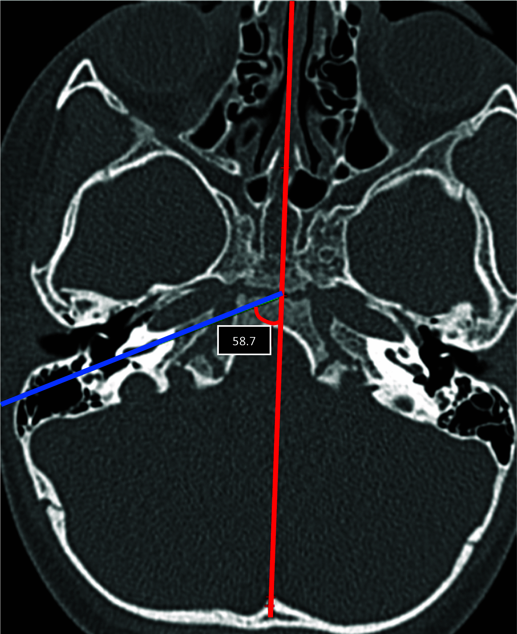 Fig. 9