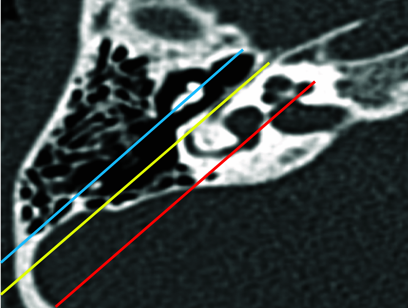 Fig. 12