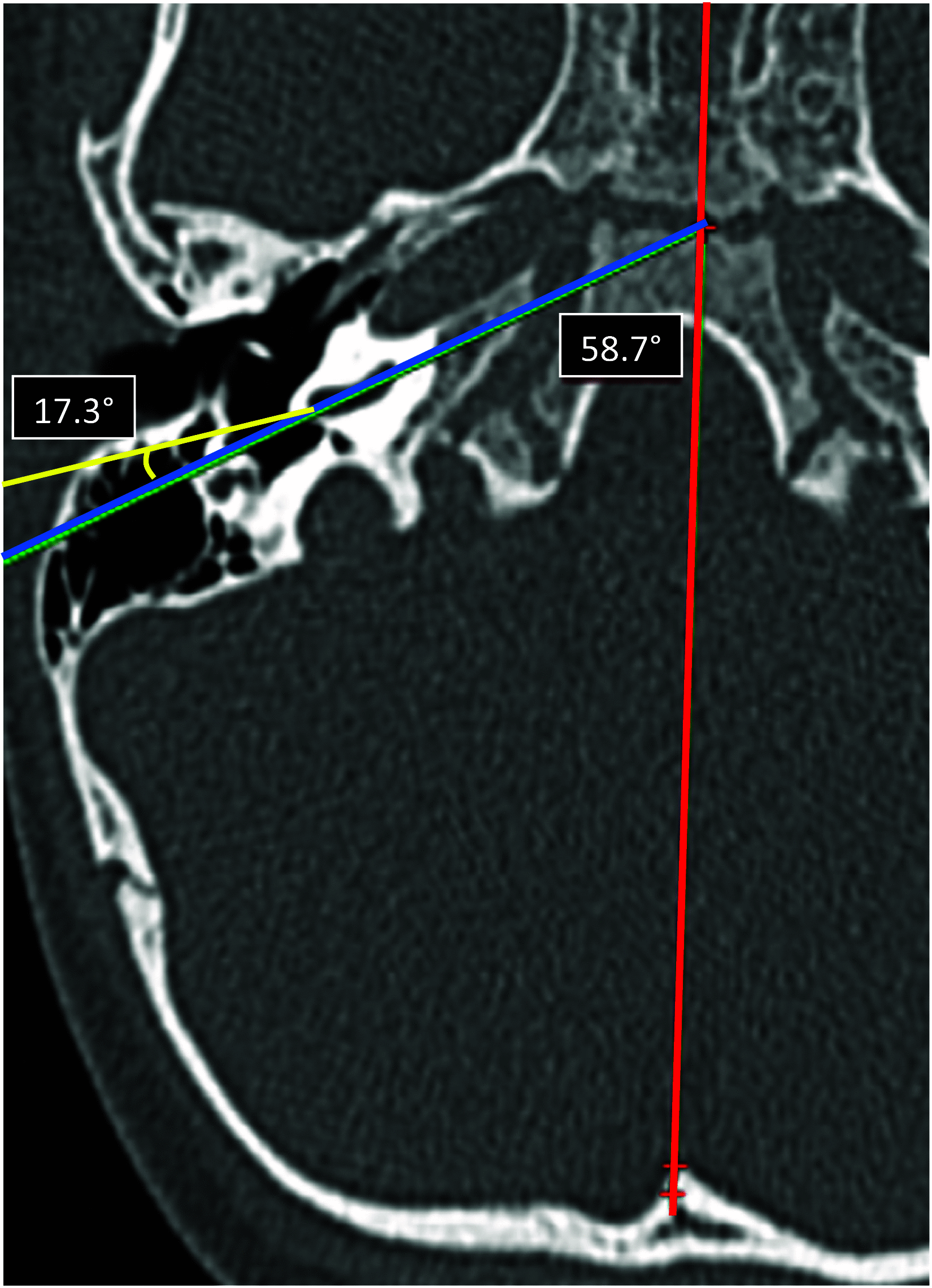 Fig. 10