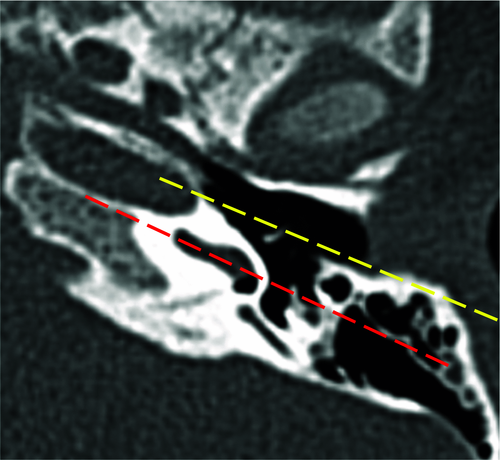 Fig. 11