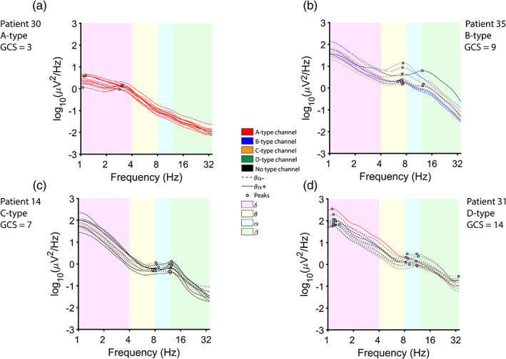 FIGURE 3