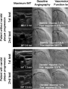 Fig. 2