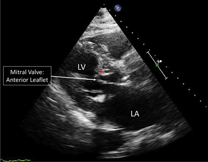 graphic file with name fx1.jpg