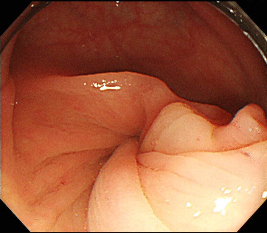 Fig. 2