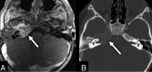 Fig 2.