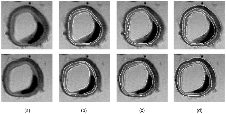 Fig. 14