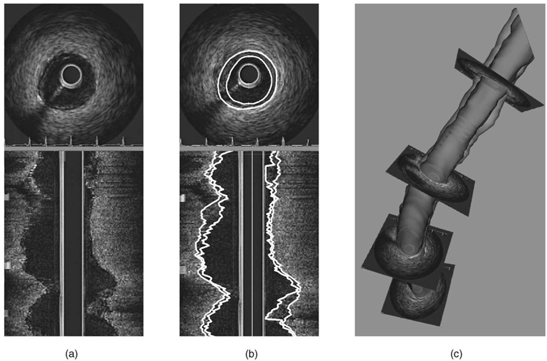 Fig. 15