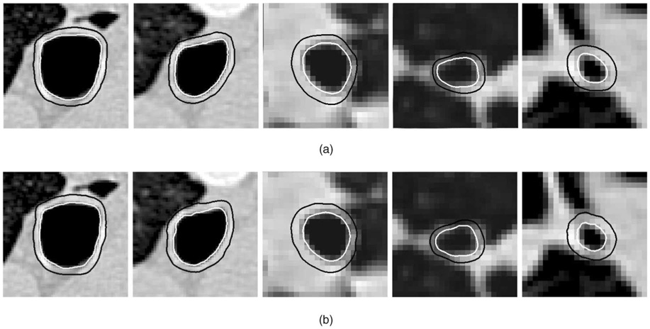 Fig. 11