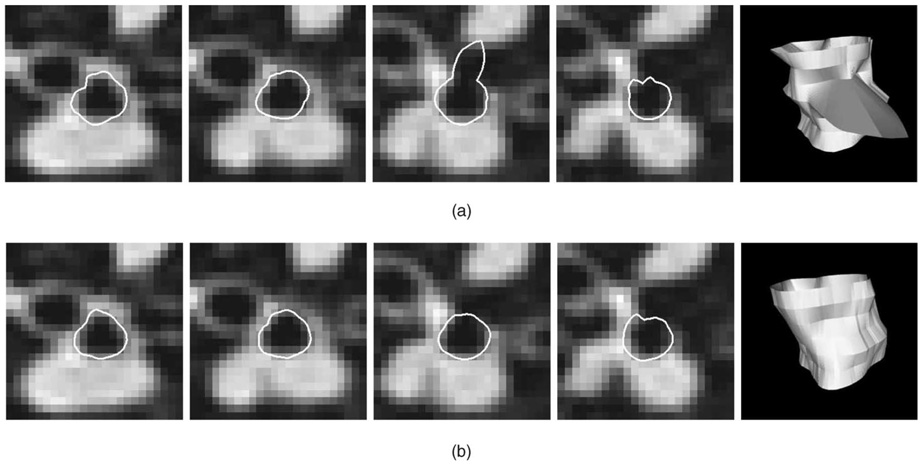 Fig. 12