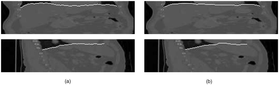 Fig. 13