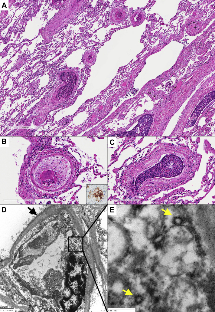 Figure 2