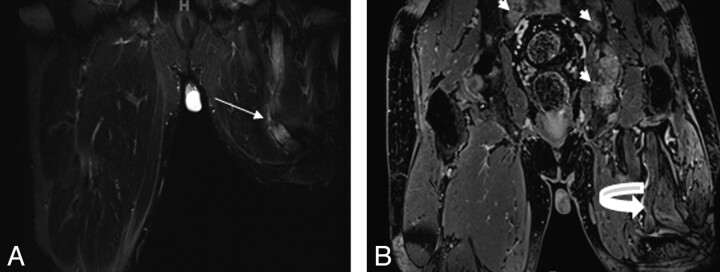 Fig 7.