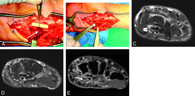 Fig 8.