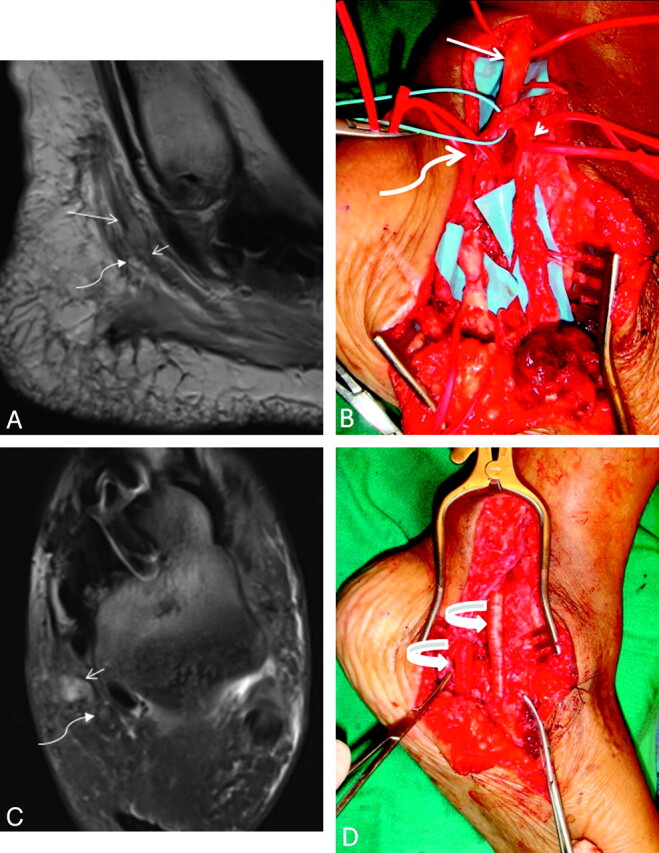 Fig 3.