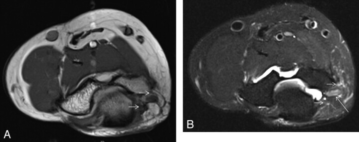 Fig 4.