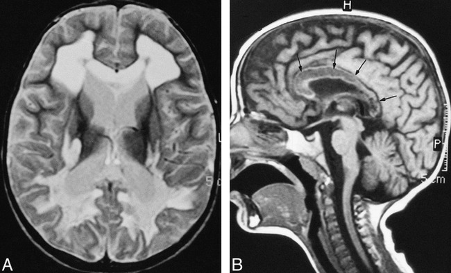 fig 2.