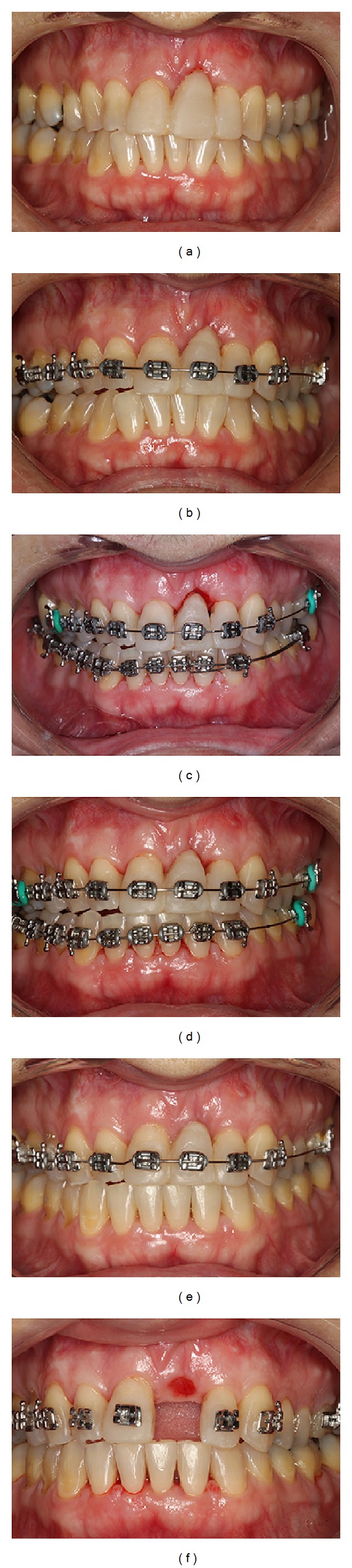 Figure 5