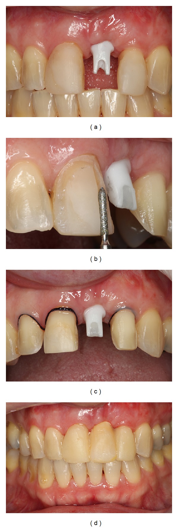 Figure 11