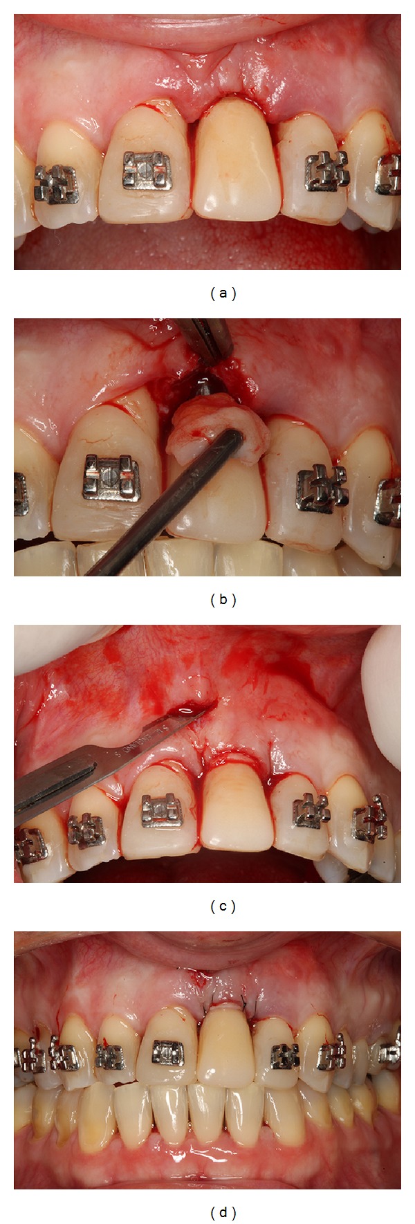 Figure 9