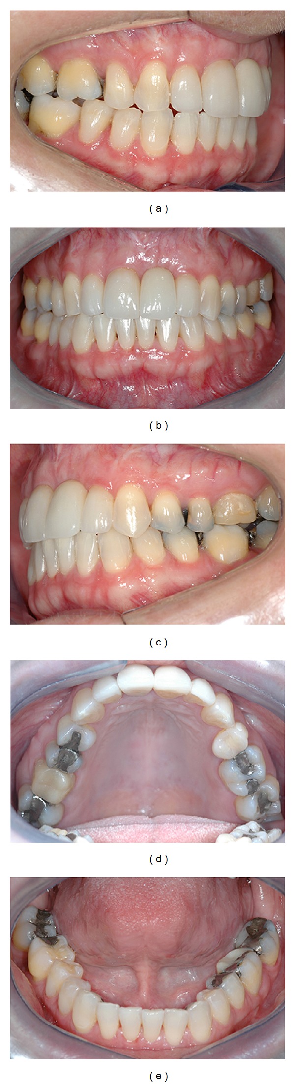 Figure 13