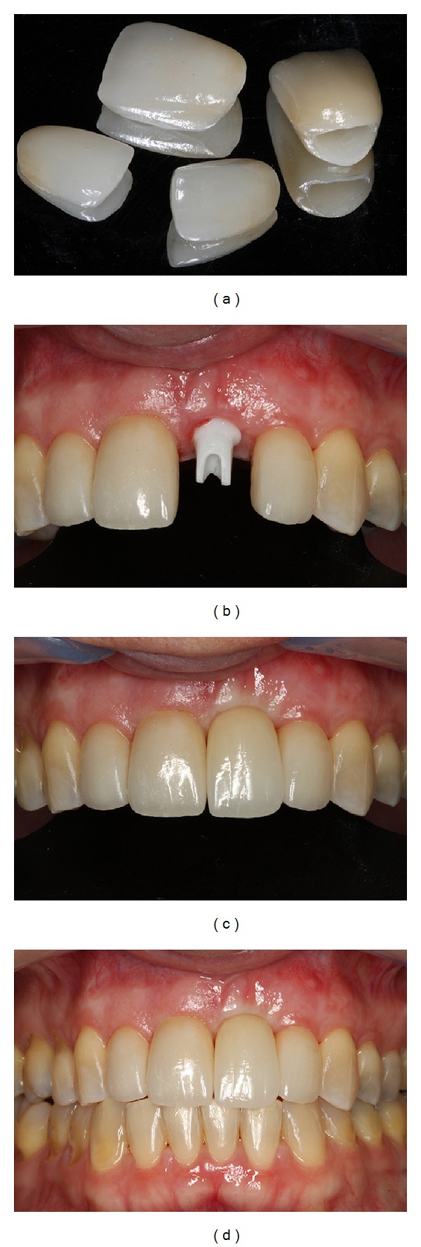 Figure 12