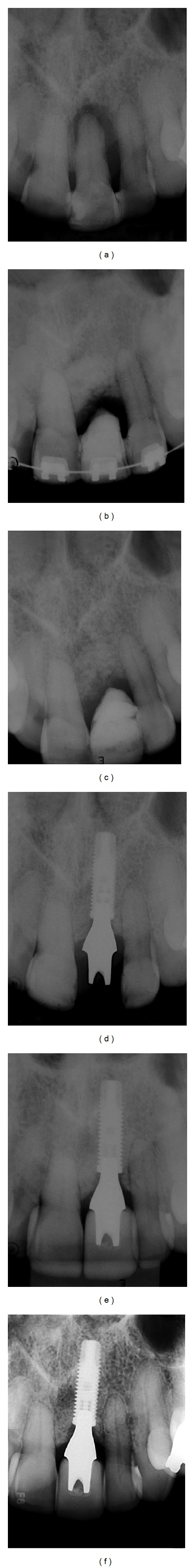 Figure 14