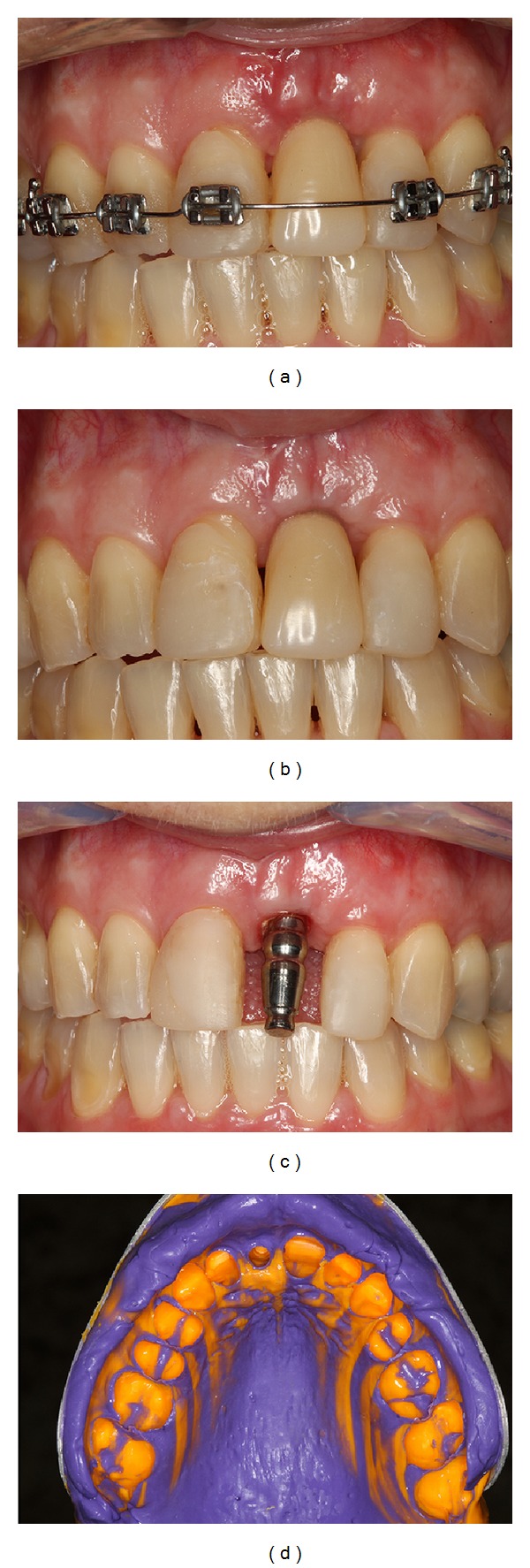 Figure 10