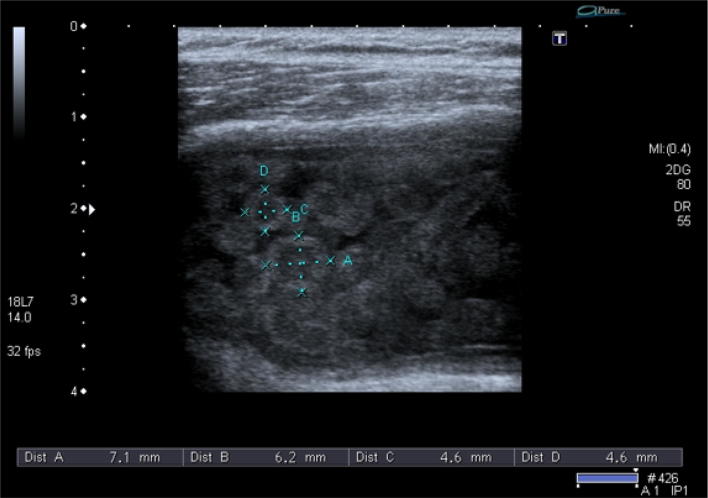 Fig. 2