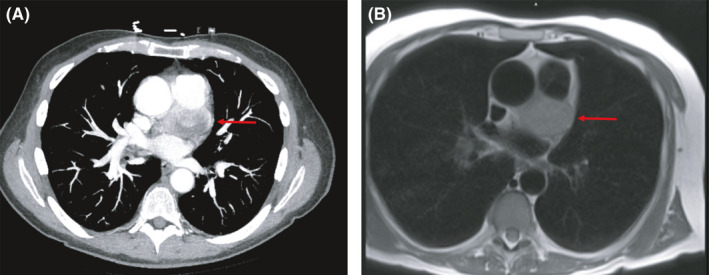 FIGURE 1