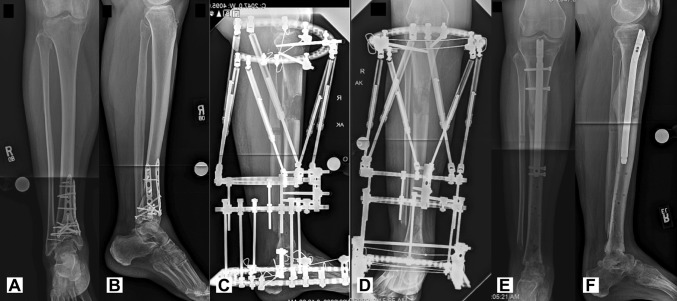 Fig. 3A–F