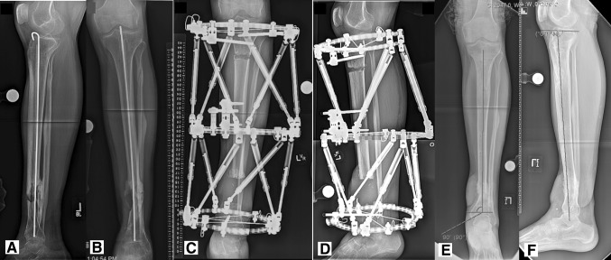 Fig. 2A–F