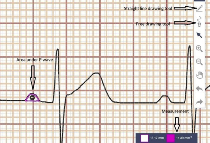 Fig. 2