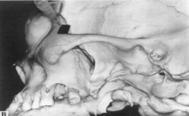 Fig. 5