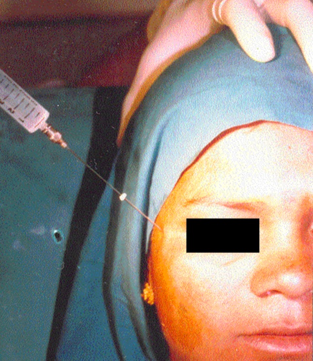 Fig. 3