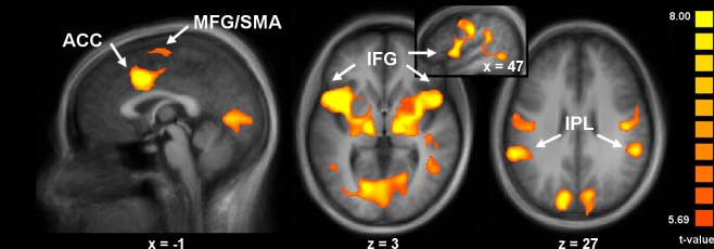 Fig 3