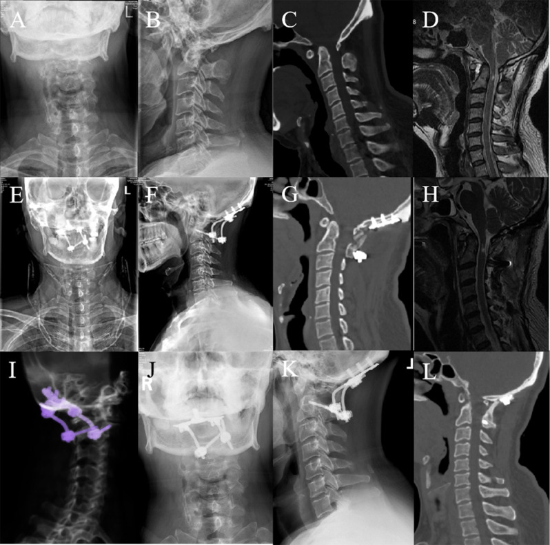 Fig. 4