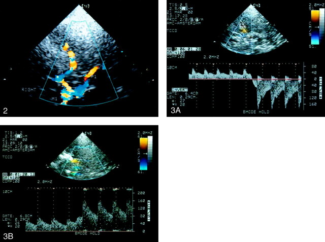 Fig 2.