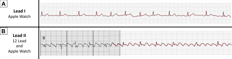 Figure 1