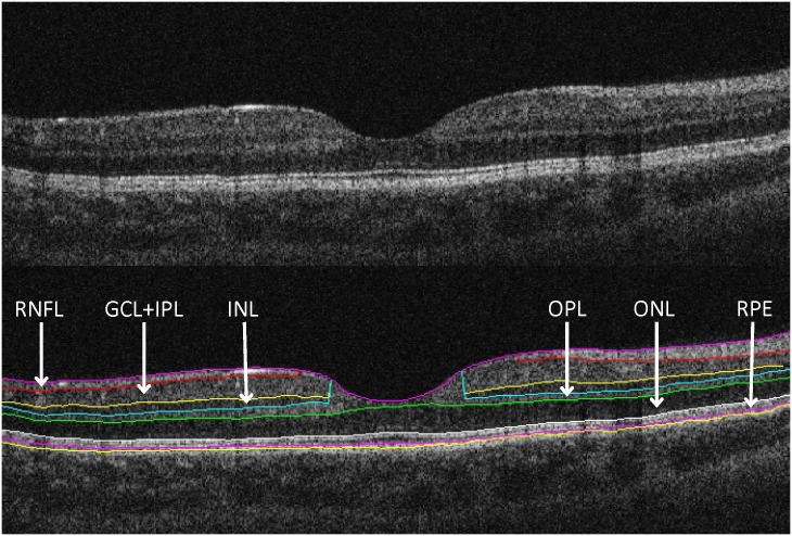 Fig 1