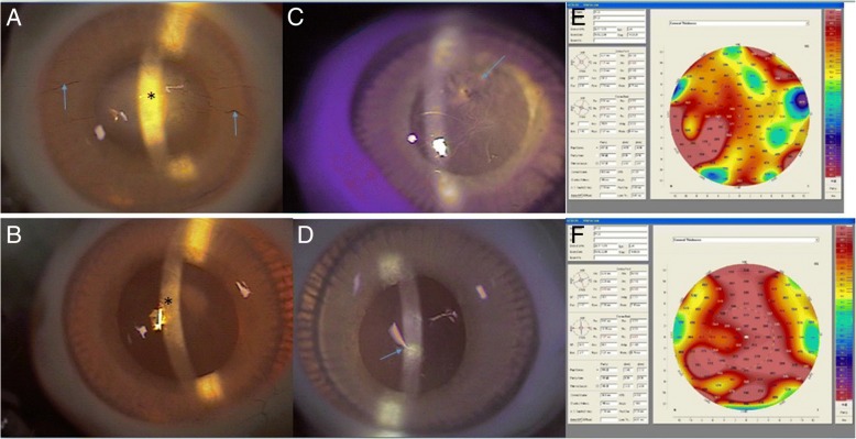 Fig. 4