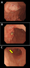 Fig. 2