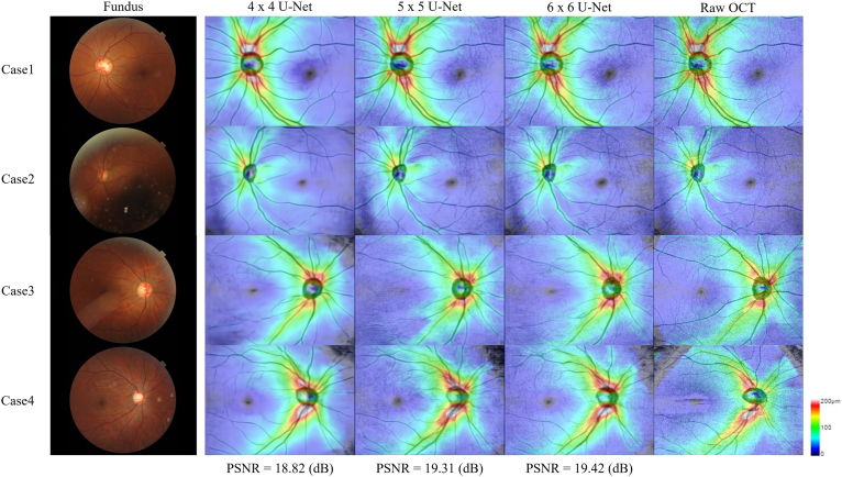 Figure 4