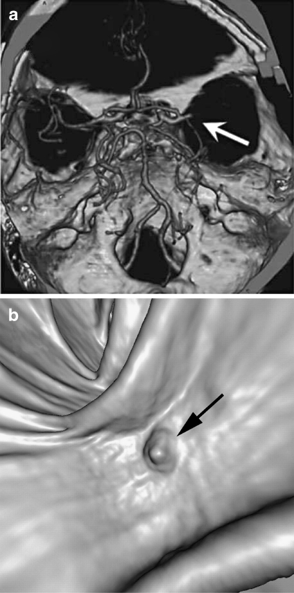 Fig 4.