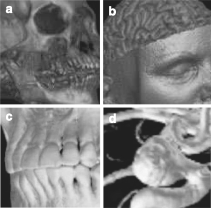 Fig 16.