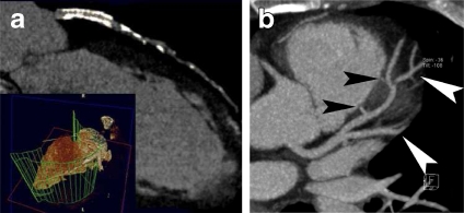 Fig 2.