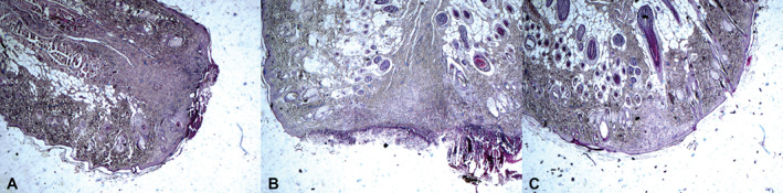 IWJ-12314-FIG-0002-c