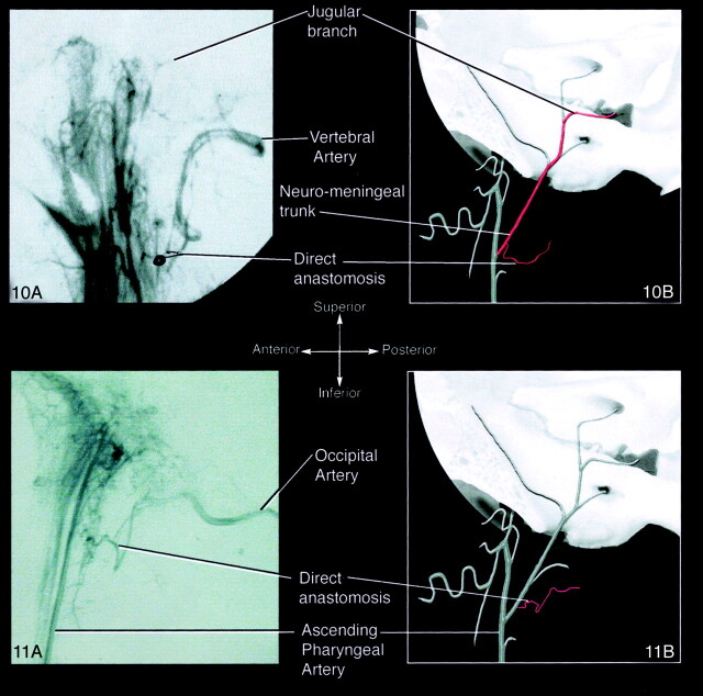 Fig 10.