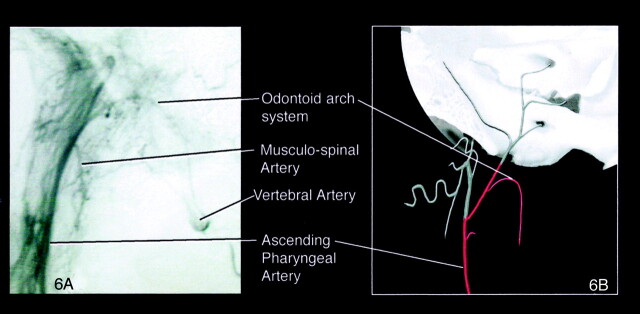 Fig 6.