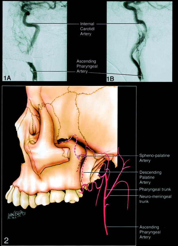 Fig 1.