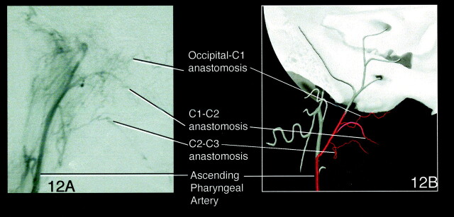 Fig 12.